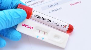 Farmaceuci testują na COVID-19.