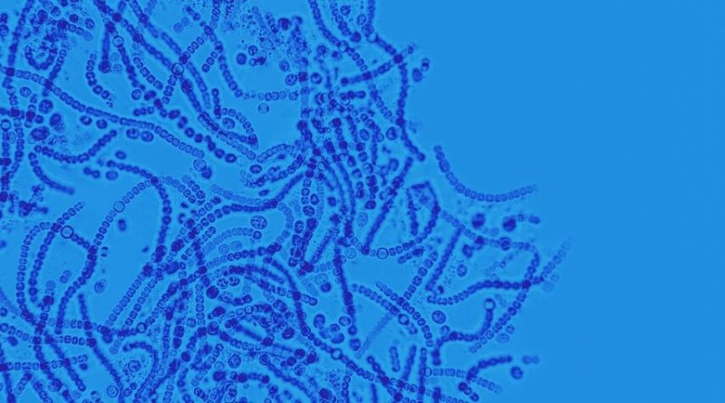 SIBO – rozpoznanie w aptece, leki OTC, objawy alarmowe