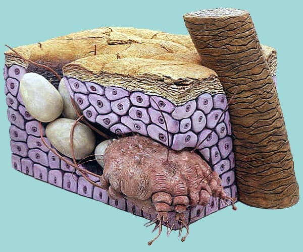 Wizualizacja świerzbowca