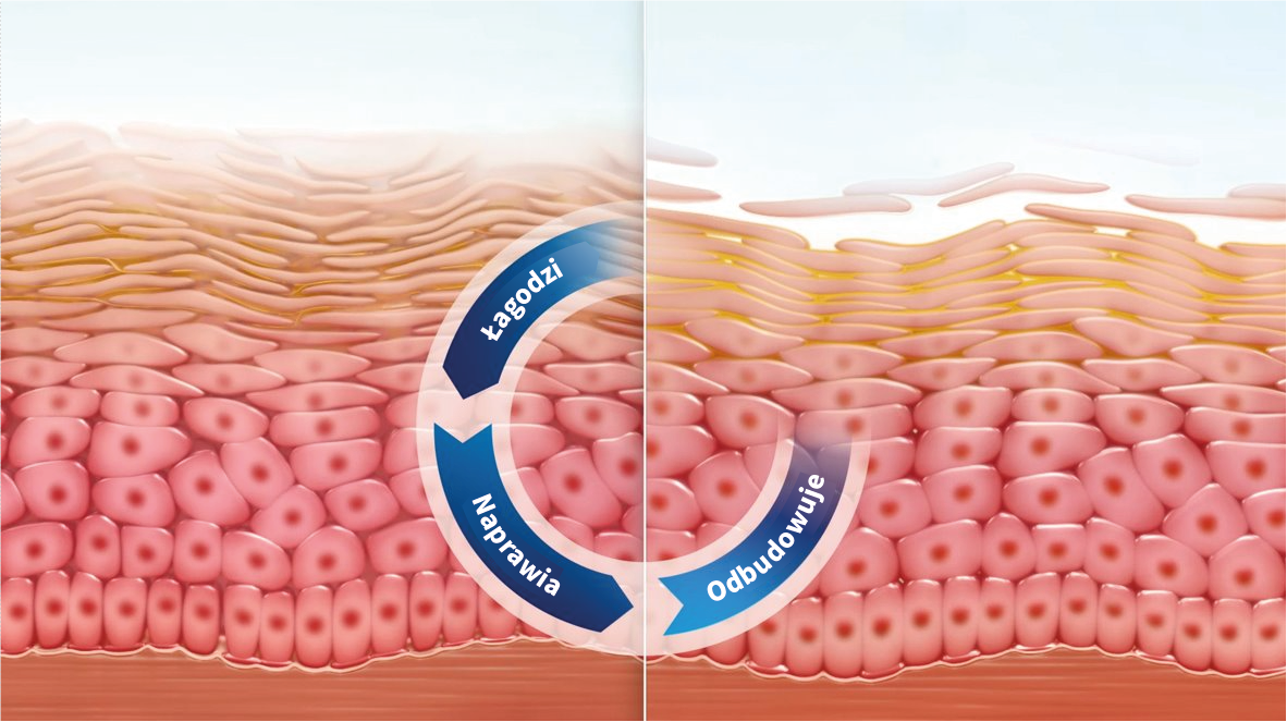 Przekrój skóry przed i po zastosowaniu pielęgnacji