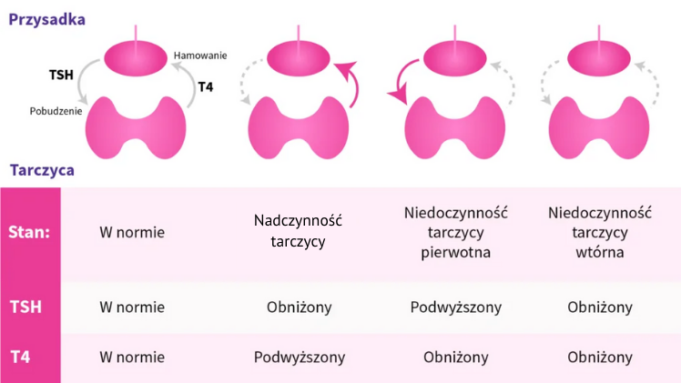 Schemat stanów tarczycy: norma, nadczynność, niedoczynność pierwotna i wtórna — poziomy TSH i T4